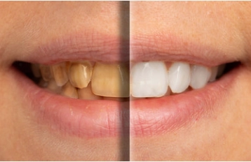 90358232422-cosmetic-dentistry.png